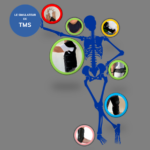 simulateur de TMS - simulateur de Troubles musculosquelettiques