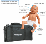 Mannequin syndrome ALCOOLEMIE FOETALE – Image 2