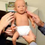 Mannequin syndrome ALCOOLEMIE FOETALE – Image 3