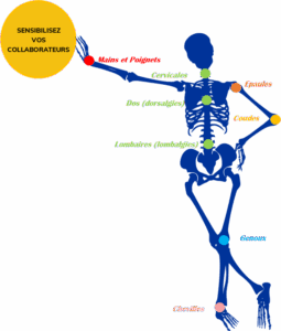 simulateur de TMS - simulateur de Troubles musculosquelettiques